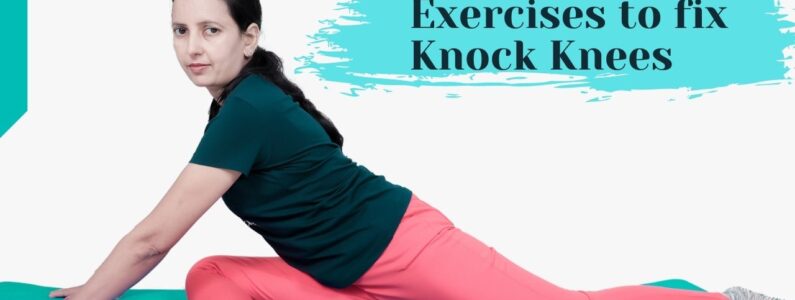 knock knees Exercises