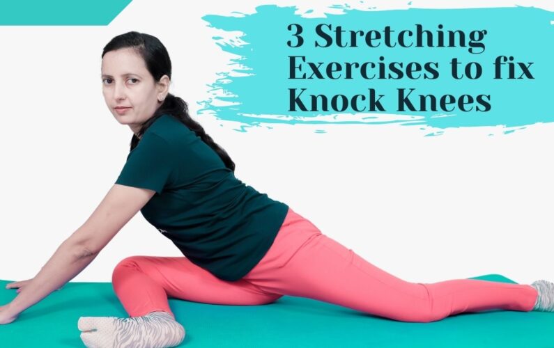 knock knees Exercises