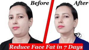 Face fat and jawline